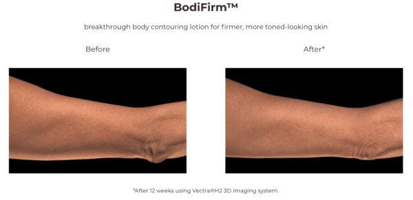 BodiFirm before and after BodiFirm before and after.