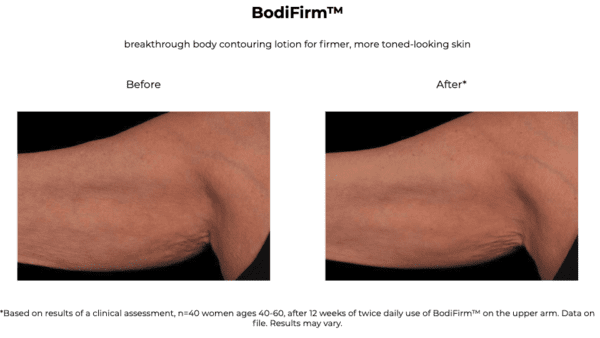 A picture of a woman's arm before and after a BodiFirm treatment.