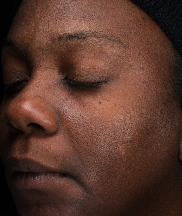 A close up of a woman's face with her eyes closed while applying the DEJ Daily Boosting Serum.