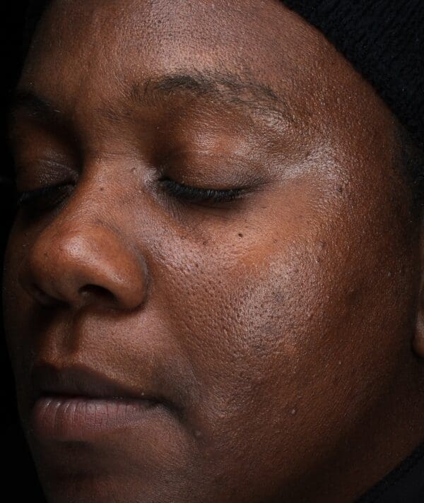 A close up of a woman's face with her eyes closed, showcasing the DEJ Daily Boosting Serum.