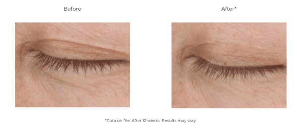 A woman's eyelashes before and after using DEJ Eye Cream treatment.