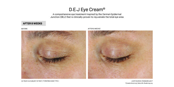 De DEJ Eye Cream before and after.