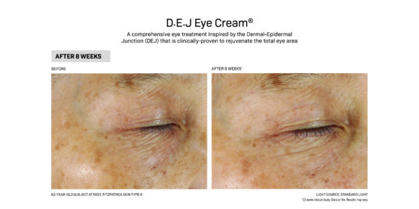 Use DEJ Eye Cream before and after.