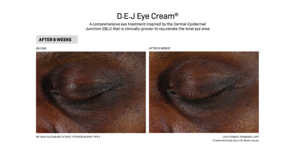 Use the DEJ Eye Cream before and after.