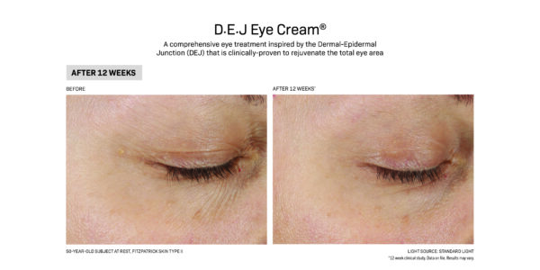 DEJ Eye Cream before and after.