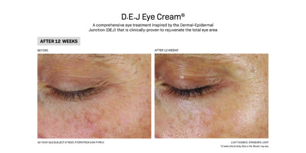 De DEJ Eye Cream before and after.