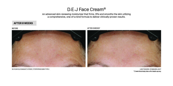 DEJ Face Cream, I use it before and after.