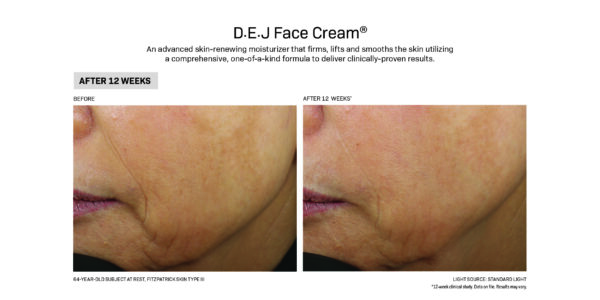 DEJ Face Cream I use before and after.