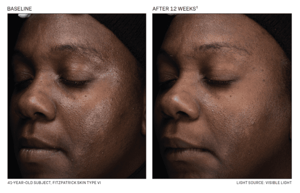 Before and after photos of a woman's face using DEJ Daily Boosting Serum.