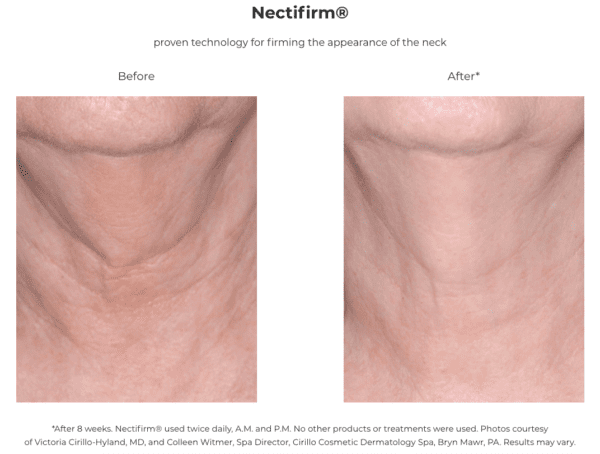 Nectifirm - before and after.