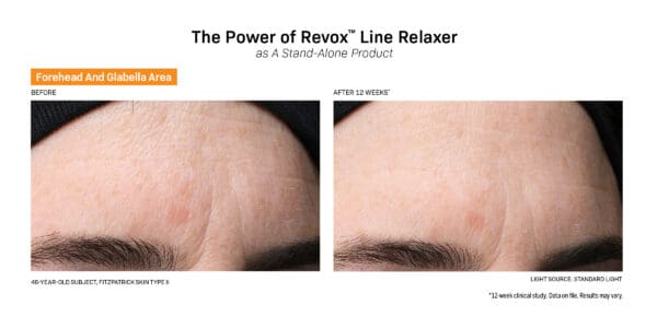 The power of Revox Line Relaxer lion balancing.