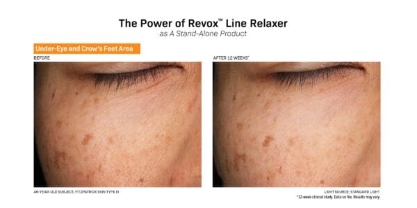 The power of Revox Line Relaxer before and after.