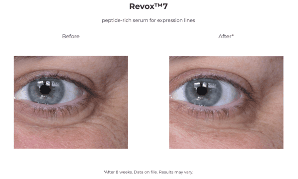 A woman's eyes are shown before and after Revox 7.