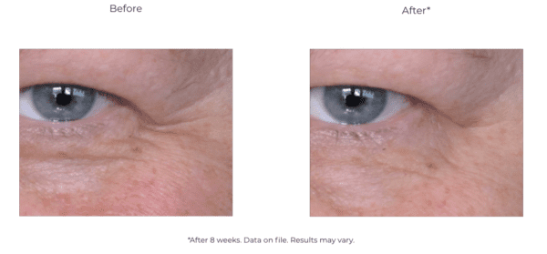 A woman's eyes before and after using Revox 7.