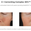 C+ Correcting Complex 30% before and after.