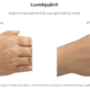 Lumiquin hand treatment before and after Lumiquin.