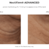 Nectifirm Advanced before and after.