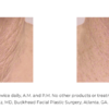 A woman's neck with wrinkles before and after using Nectifirm treatment.