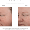 Retinol Complete 0.5 - before and after.