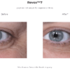 A woman's eyes are shown before and after Revox 7.