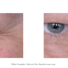 A woman's eyes before and after using Revox 7.